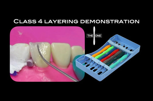 Class 4 composite layering demonstration - Incidental