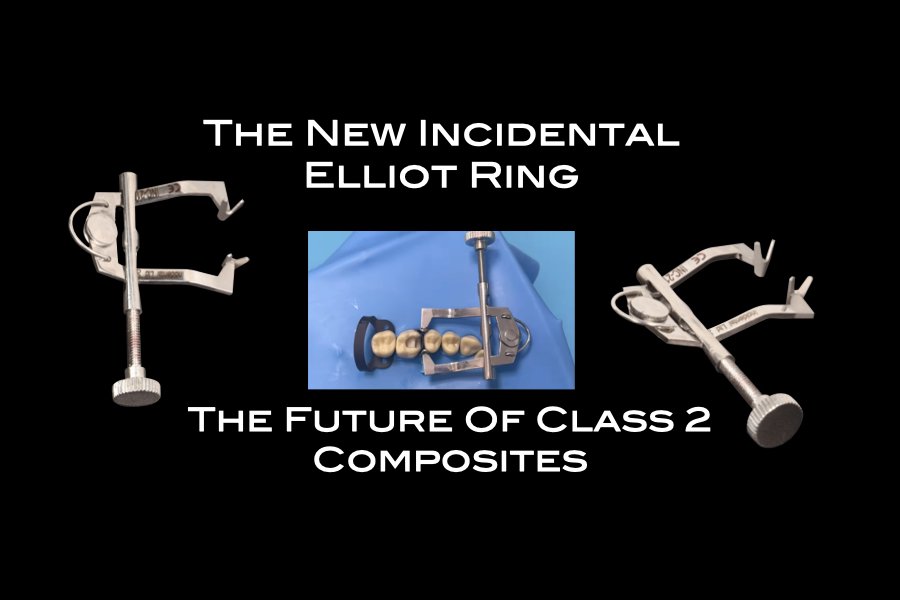 Introducing the Elliot Ring - Incidental