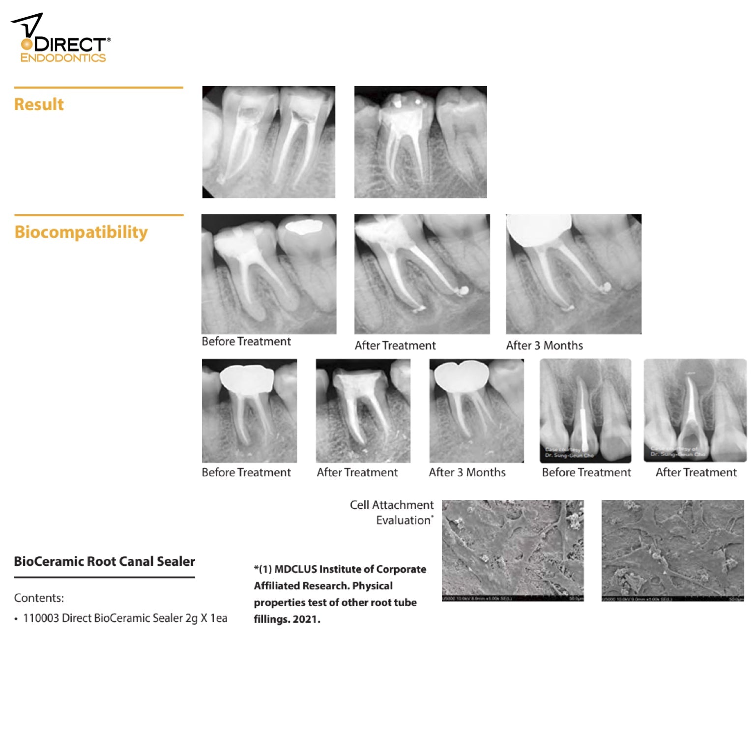 DirectBioceramic Sealer - Incidental