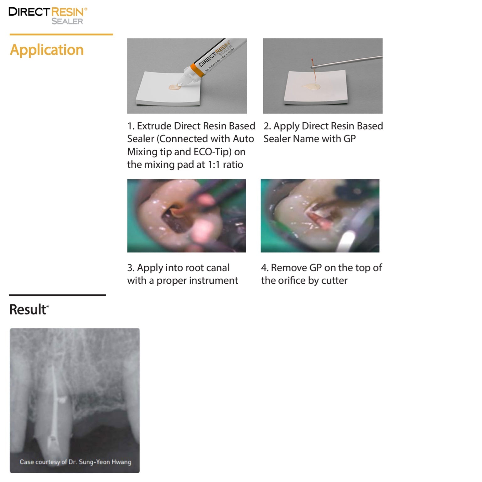 DirectResin Sealer - Incidental